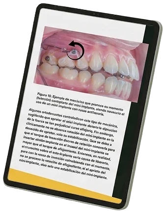 Guía de Planificación con Tomografía